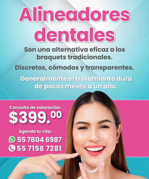 Alineadores Dentales