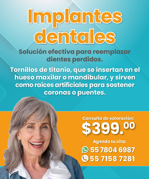 Alineadores Dentales