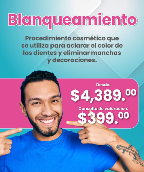 Alineadores Dentales